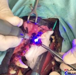 Veterinary oral laser surgery